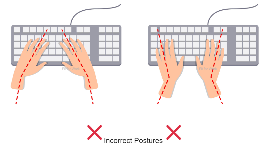 Illustration des mains sur un clavier, quand les poignets sont tordus, c'est pas bon